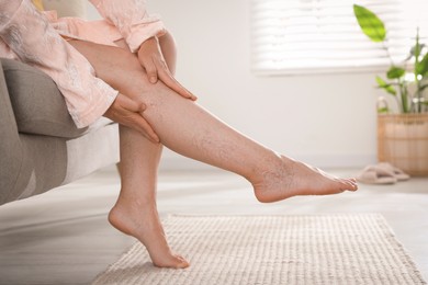 Photo of Woman suffering from varicose veins on sofa indoors, closeup