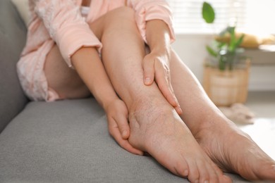 Photo of Woman suffering from varicose veins on sofa indoors, closeup