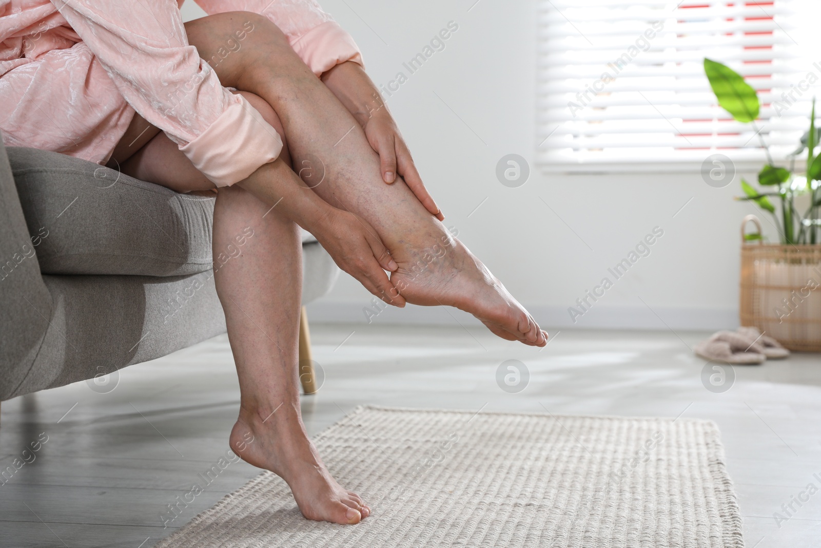 Photo of Woman suffering from varicose veins on sofa indoors, closeup. Space for text