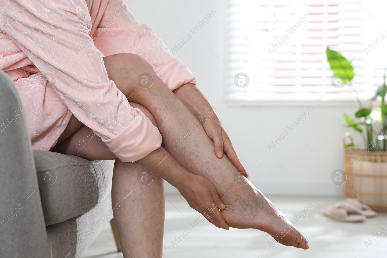 Photo of Woman suffering from varicose veins on sofa indoors, closeup. Space for text