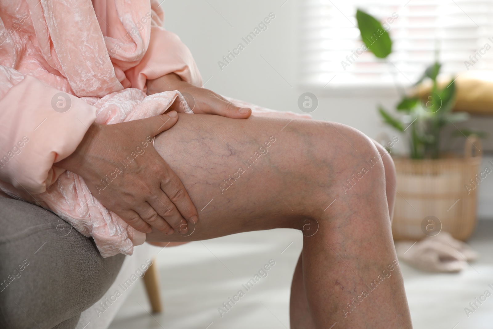 Photo of Woman suffering from varicose veins on sofa indoors, closeup