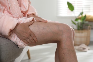 Photo of Woman suffering from varicose veins on sofa indoors, closeup