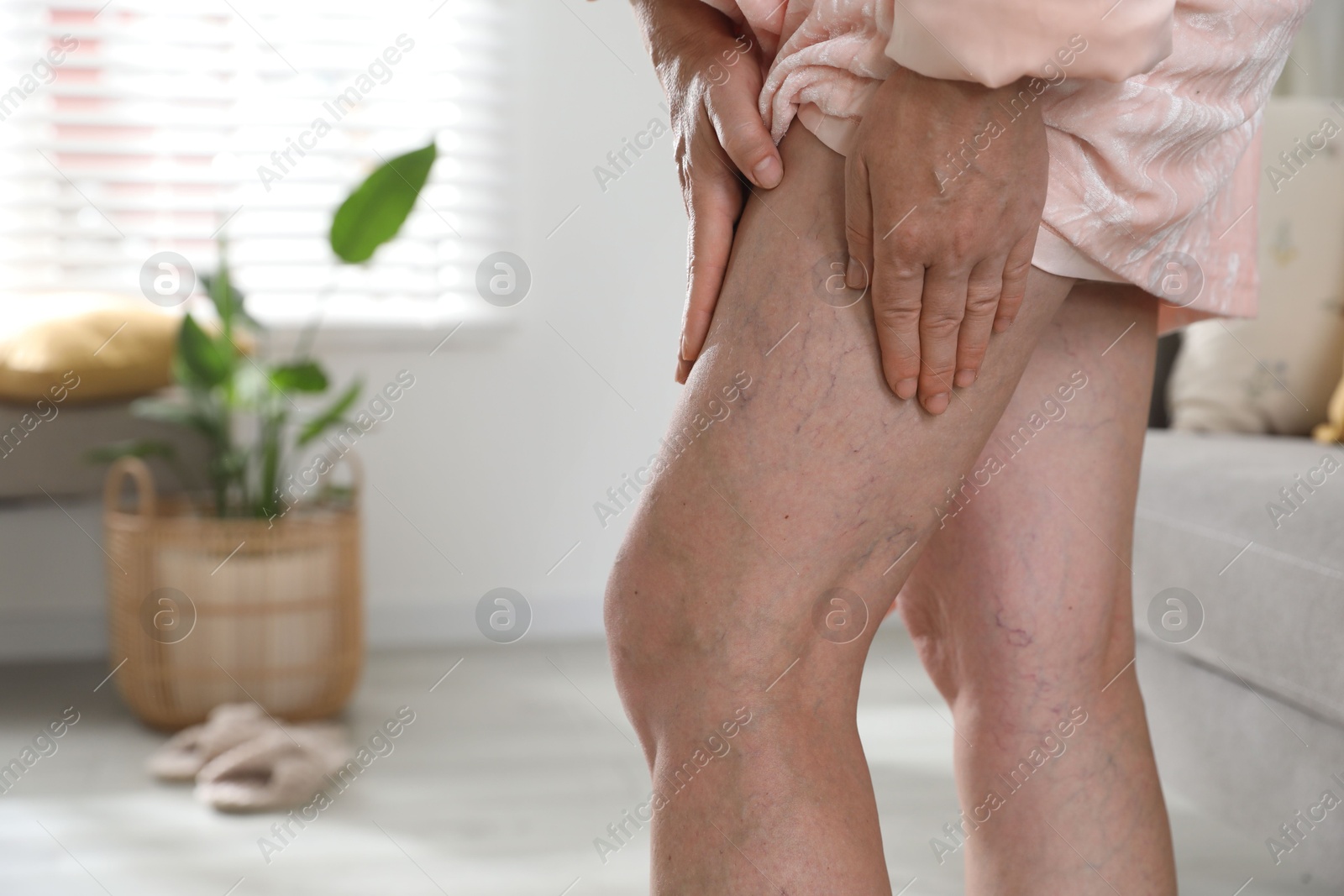 Photo of Woman suffering from varicose veins indoors, closeup. Space for text