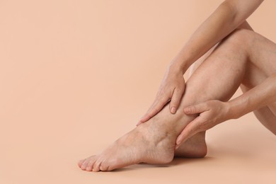 Woman suffering from varicose veins on beige background, closeup. Space for text