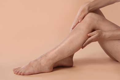 Photo of Woman suffering from varicose veins on beige background, closeup