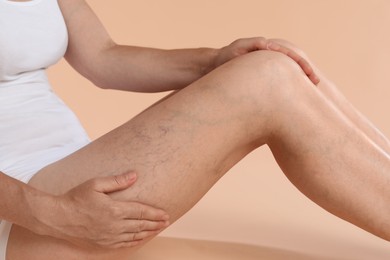 Woman suffering from varicose veins on beige background, closeup