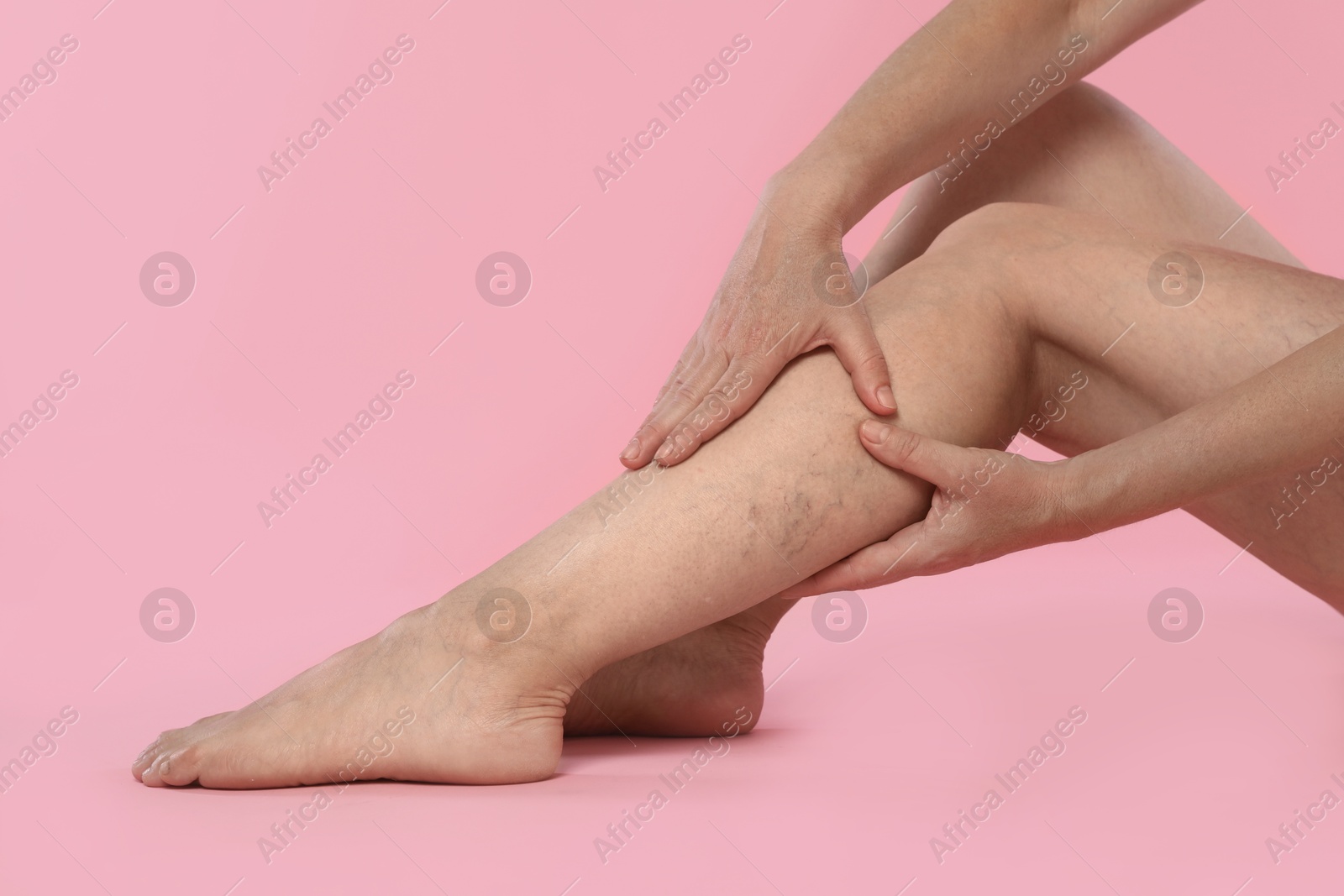 Photo of Woman suffering from varicose veins on pink background, closeup