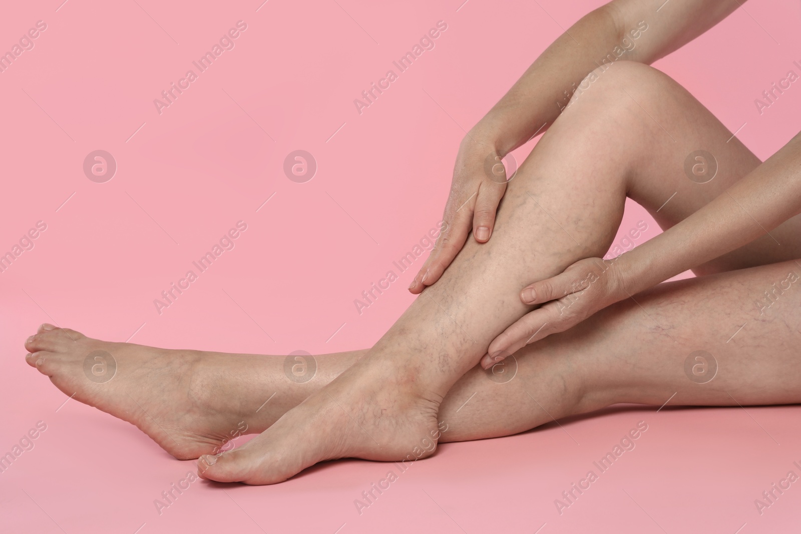 Photo of Woman suffering from varicose veins on pink background, closeup