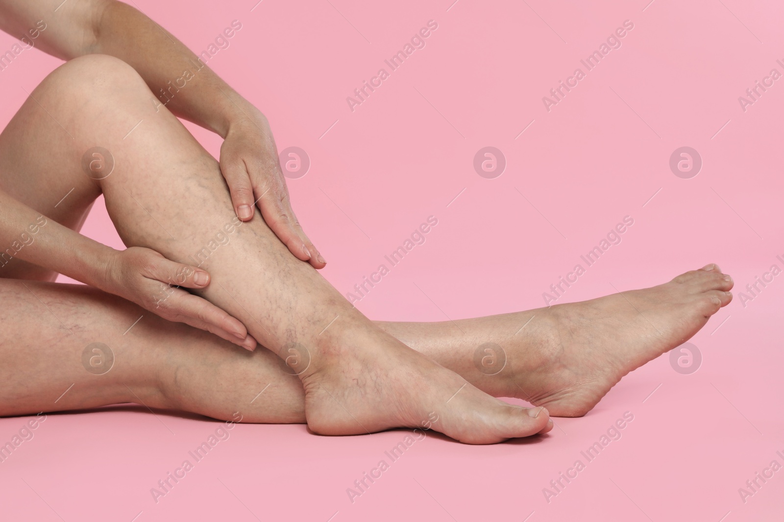 Photo of Woman suffering from varicose veins on pink background, closeup