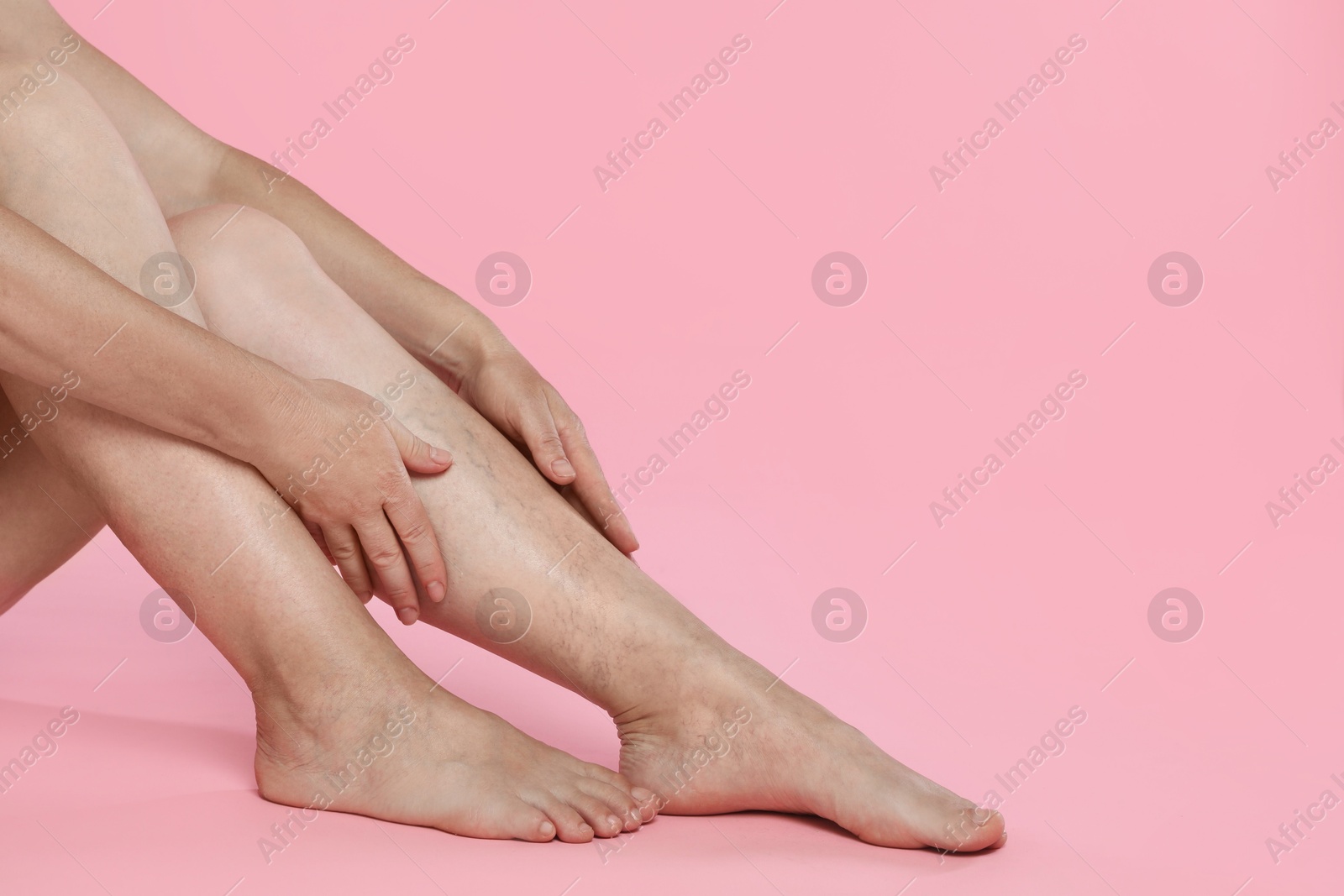 Photo of Woman suffering from varicose veins on pink background, closeup. Space for text