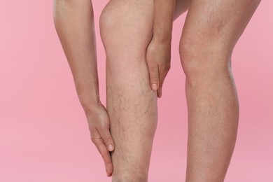 Photo of Woman suffering from varicose veins on pink background, closeup