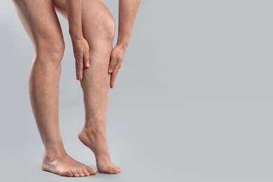 Photo of Woman suffering from varicose veins on grey background, closeup. Space for text