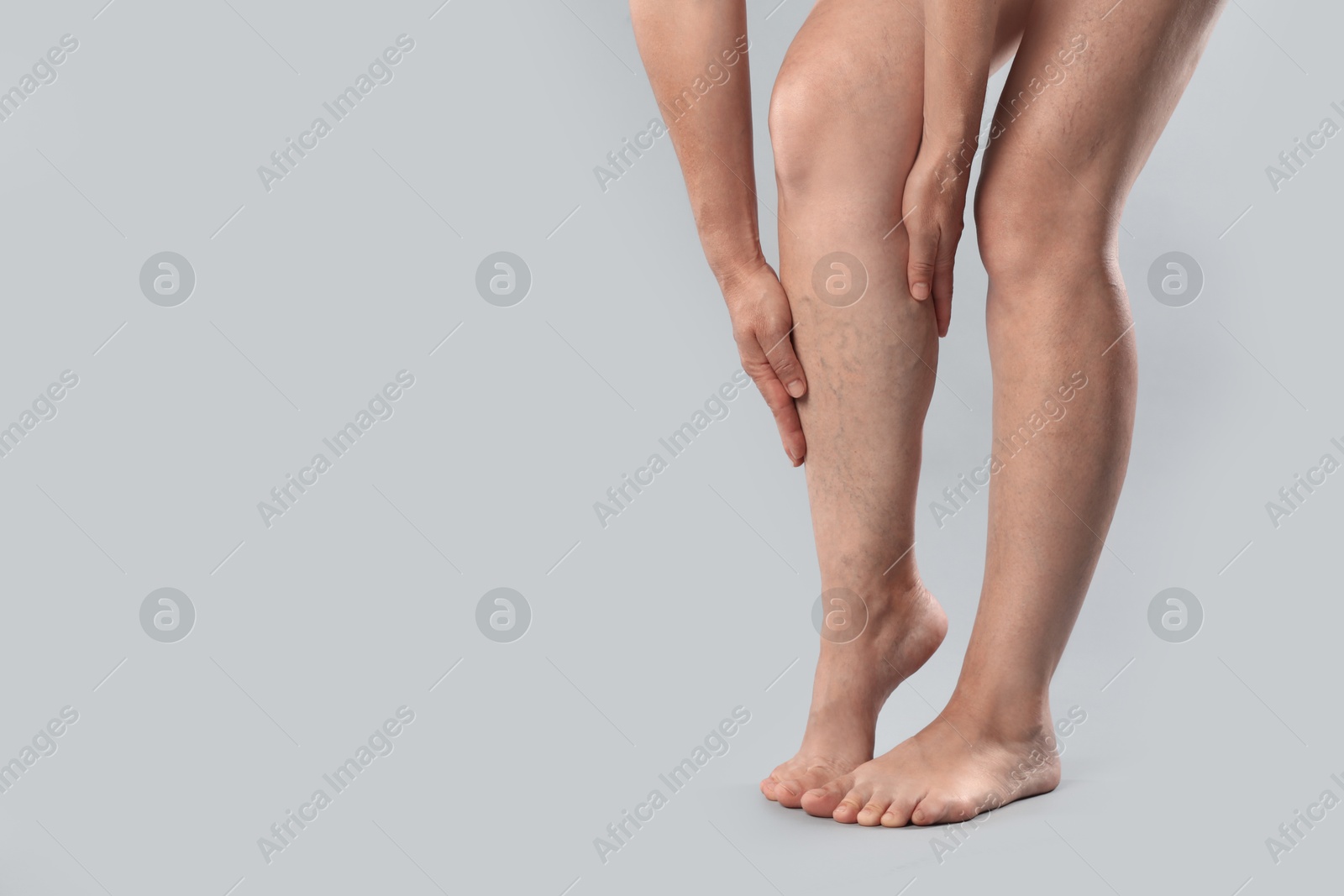 Photo of Woman suffering from varicose veins on grey background, closeup. Space for text