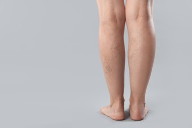 Photo of Woman with varicose veins on grey background, closeup. Space for text