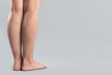 Photo of Woman with varicose veins on grey background, closeup. Space for text