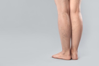 Photo of Woman with varicose veins on grey background, closeup. Space for text