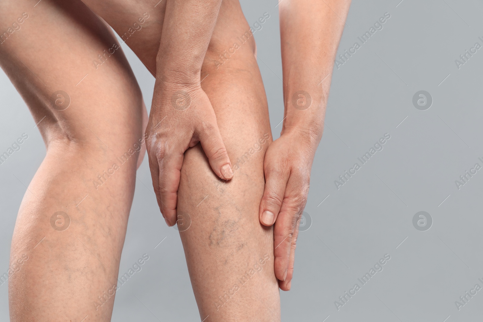 Photo of Woman suffering from varicose veins on grey background, closeup. Space for text