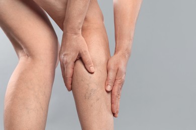 Woman suffering from varicose veins on grey background, closeup. Space for text