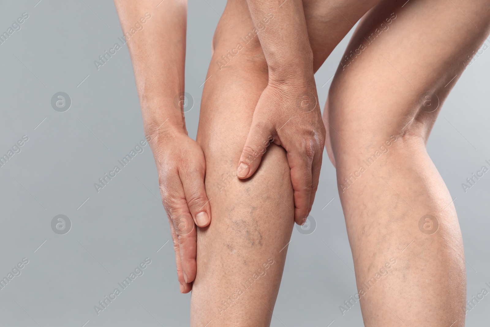 Photo of Woman suffering from varicose veins on grey background, closeup. Space for text