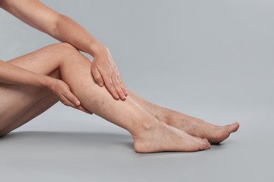 Photo of Woman suffering from varicose veins on grey background, closeup