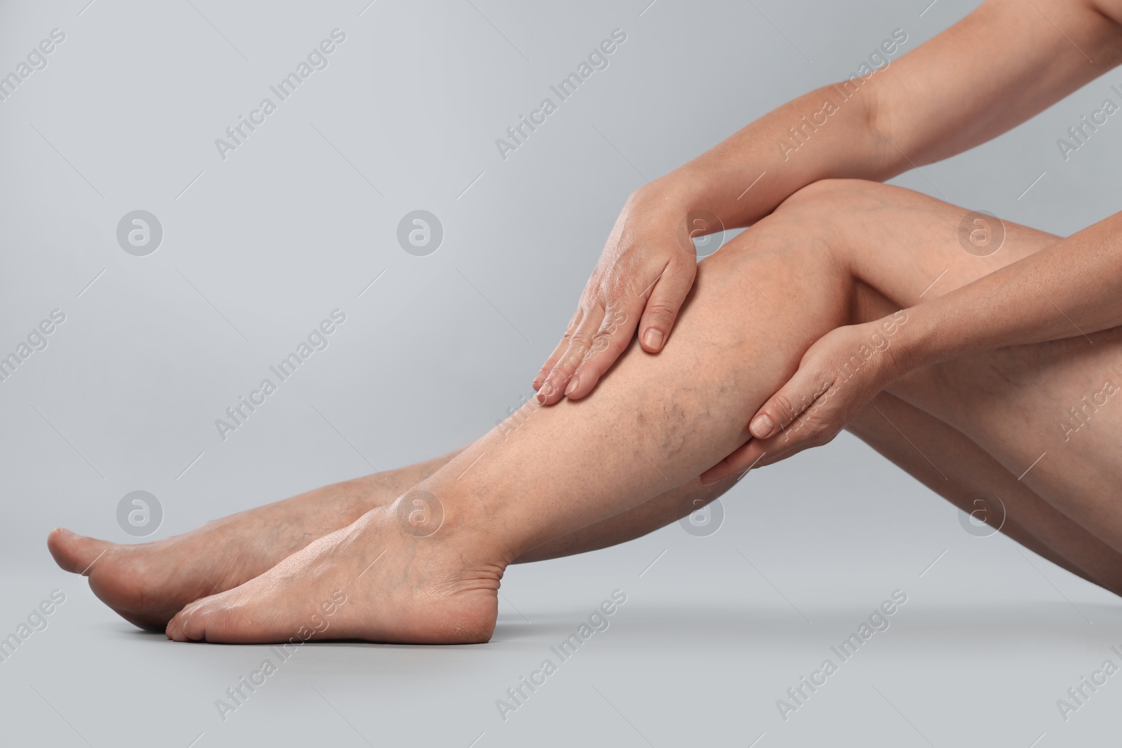 Photo of Woman suffering from varicose veins on grey background, closeup