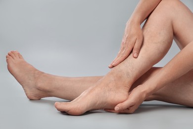 Photo of Woman suffering from varicose veins on grey background, closeup