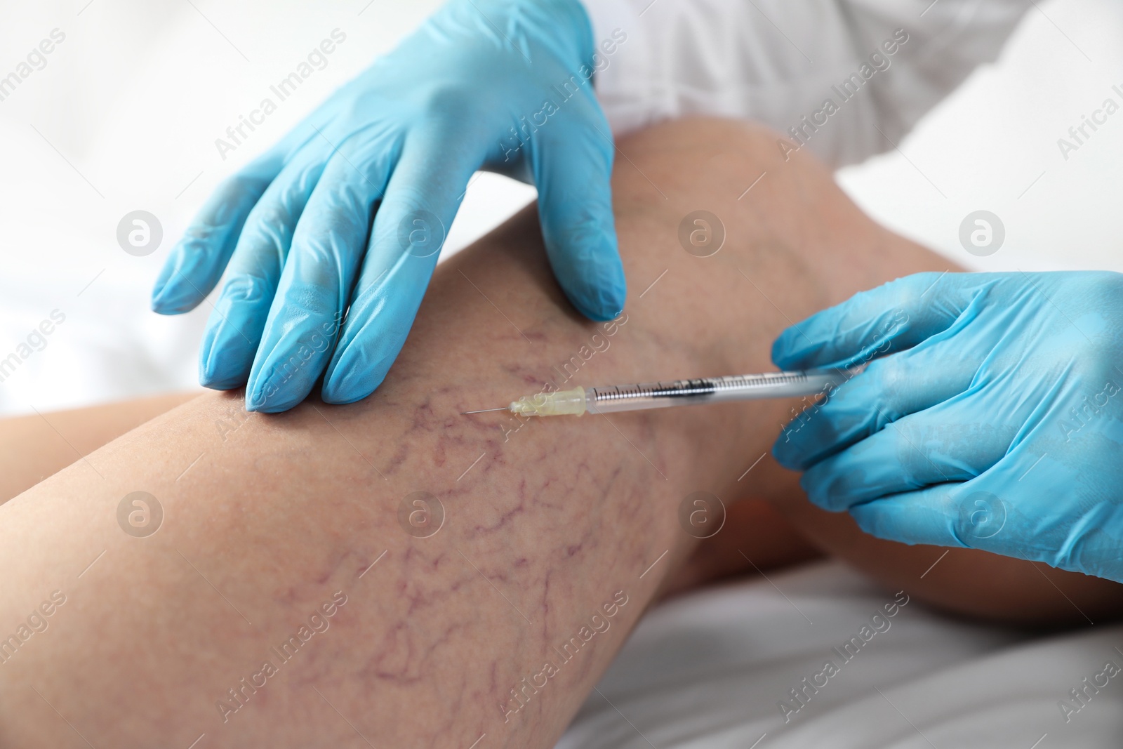 Photo of Varicose veins treatment. Doctor giving injection to patient indoors, closeup