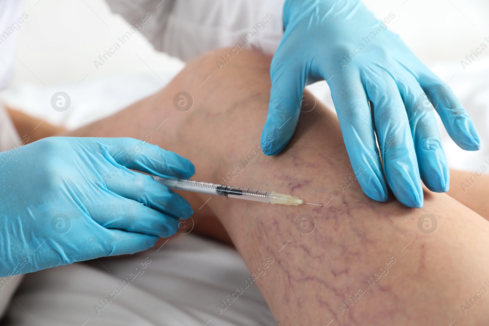 Photo of Varicose veins treatment. Doctor giving injection to patient indoors, closeup