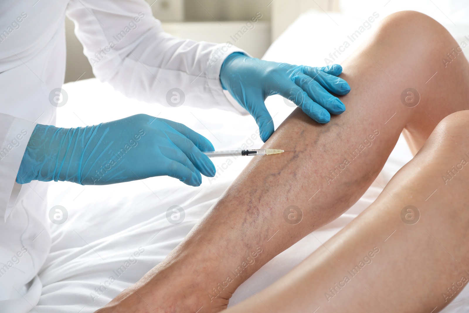 Photo of Varicose veins treatment. Doctor giving injection to patient indoors, closeup