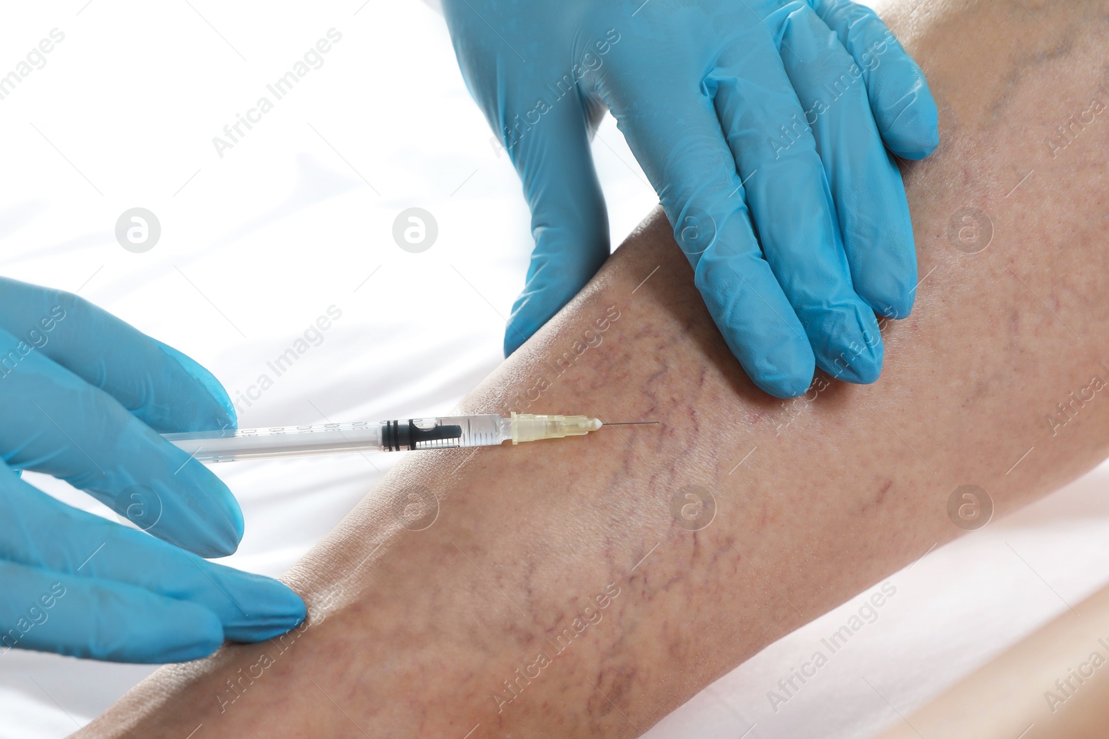 Photo of Varicose veins treatment. Doctor giving injection to patient indoors, closeup