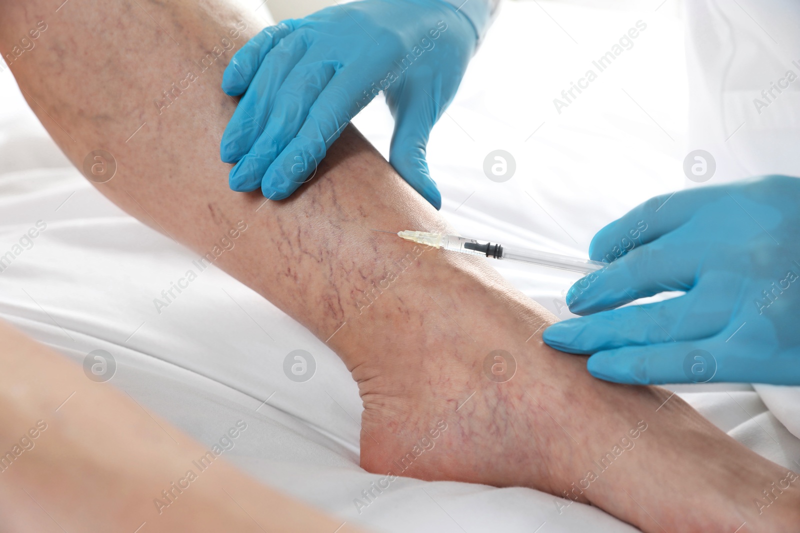 Photo of Varicose veins treatment. Doctor giving injection to patient indoors, closeup