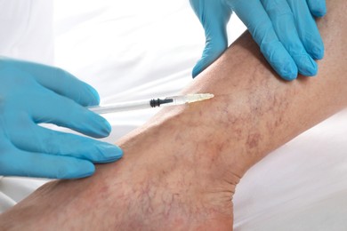 Varicose veins treatment. Doctor giving injection to patient indoors, closeup