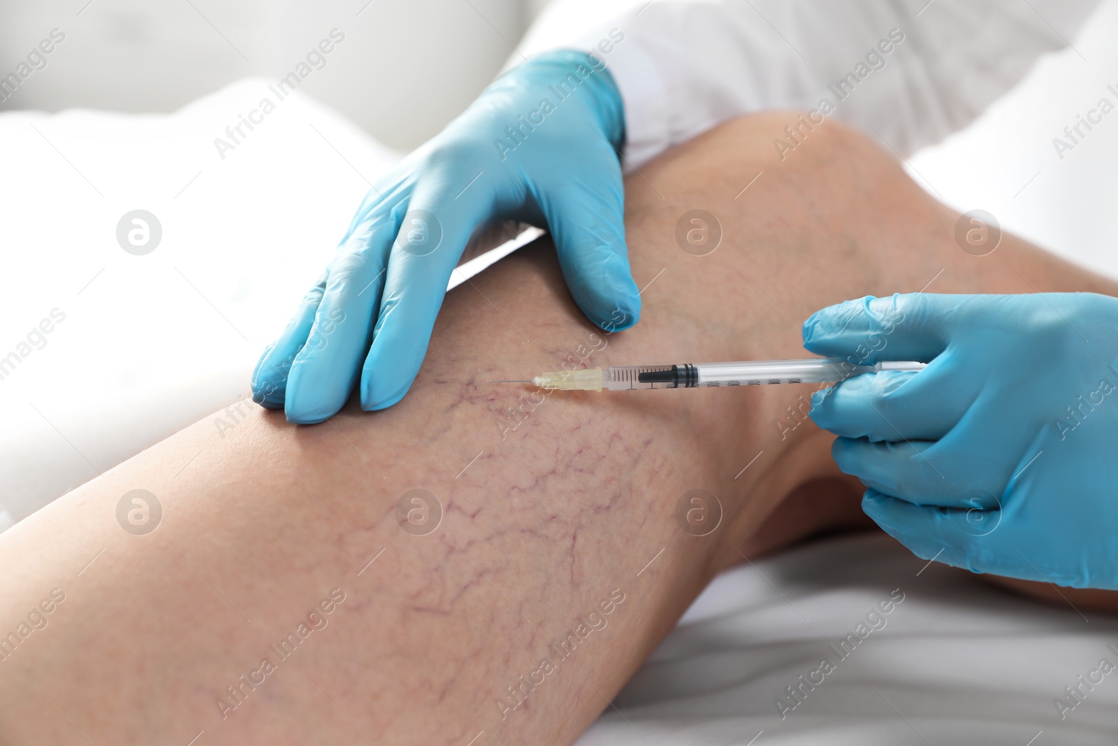 Photo of Varicose veins treatment. Doctor giving injection to patient indoors, closeup