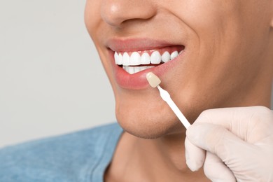 Doctor checking young man's teeth color on gray background, closeup. Dental veneers