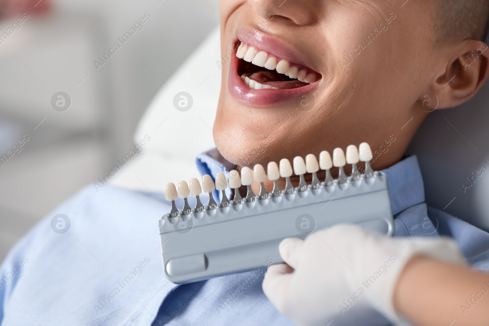 Photo of Doctor checking young man's teeth color in clinic, closeup. Dental veneers