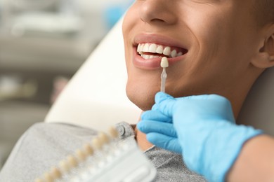 Doctor checking young man's teeth color in clinic, closeup. Dental veneers