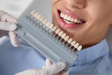 Doctor checking young man's teeth color in clinic, closeup. Dental veneers