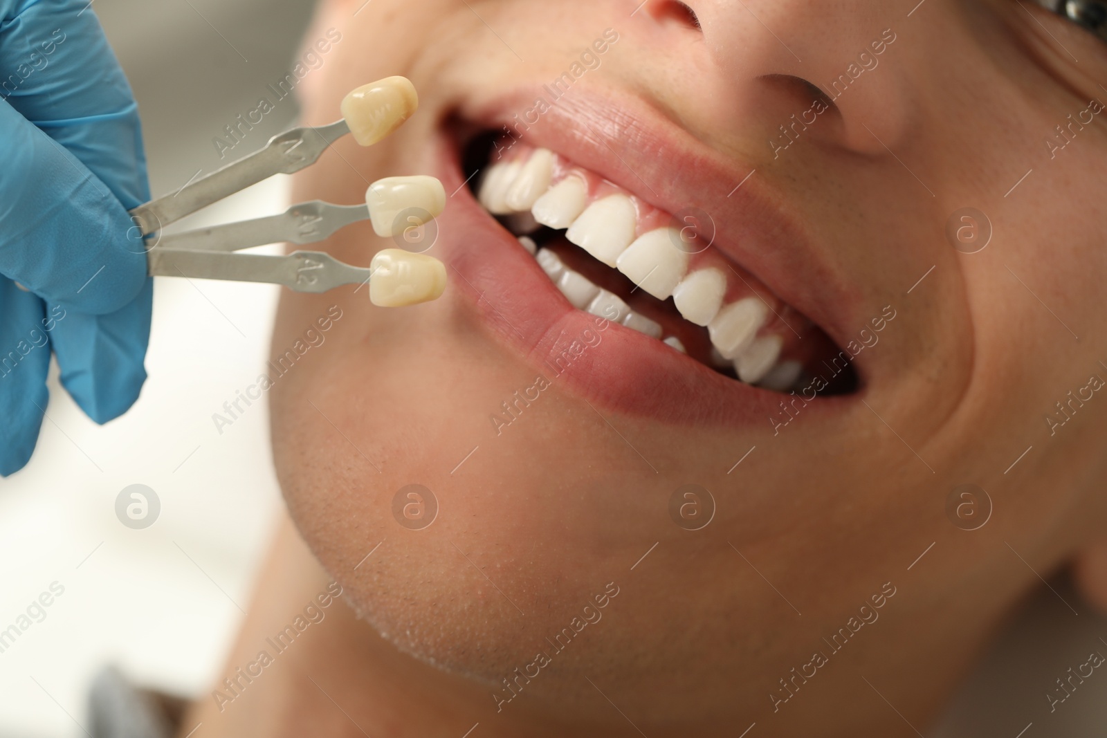 Photo of Doctor checking young man's teeth color in clinic, closeup. Dental veneers