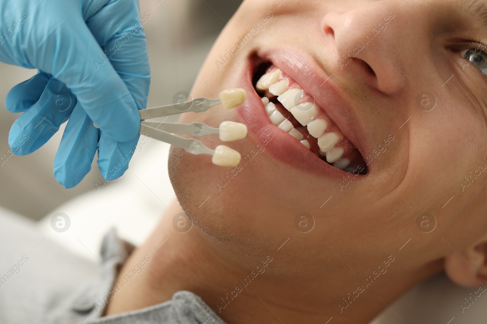 Photo of Doctor checking young man's teeth color in clinic, closeup. Dental veneers