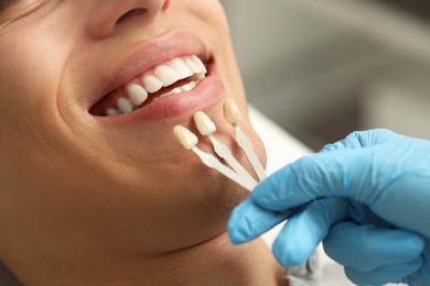 Photo of Doctor checking young man's teeth color in clinic, closeup. Dental veneers