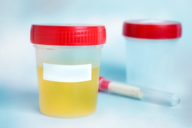 Urine sample in jar with blank label on table, space for text. Laboratory analysis