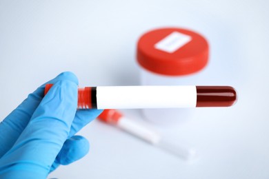 Image of Laboratory worker holding test tube with blood sample and blank label over table, closeup. Medical analysis