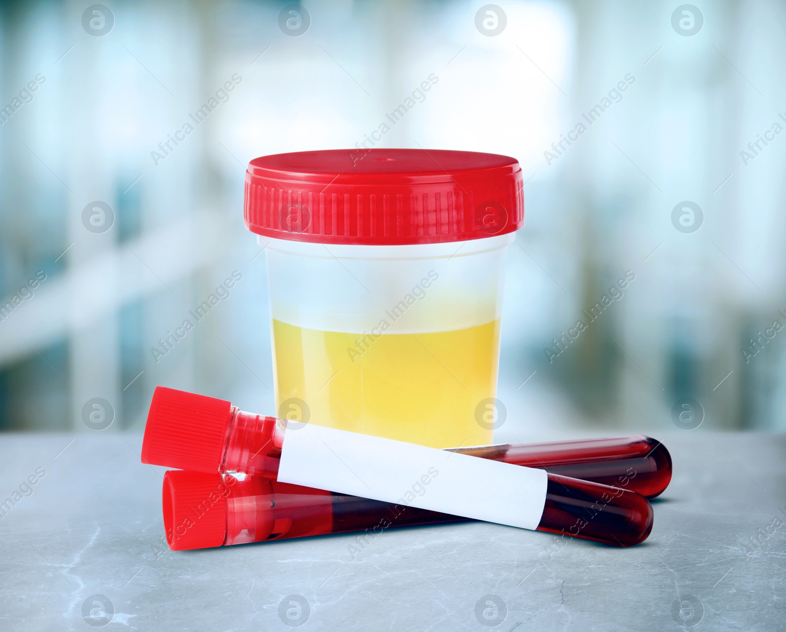 Image of Test tubes with blood samples and jar of urine on table in laboratory. Medical analysis