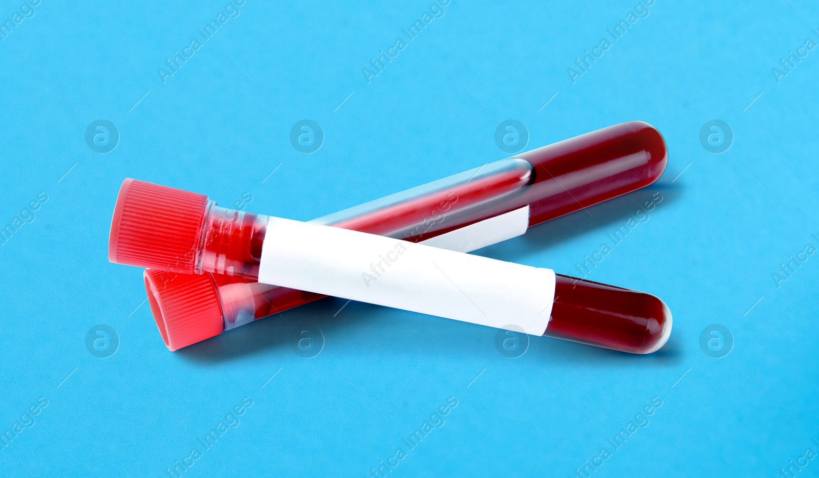 Image of Blood in test tubes with blank labels on light blue background. Medical analysis