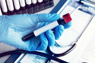 Image of Laboratory worker holding test tube with blood and blank label over table, closeup, Medical analysis