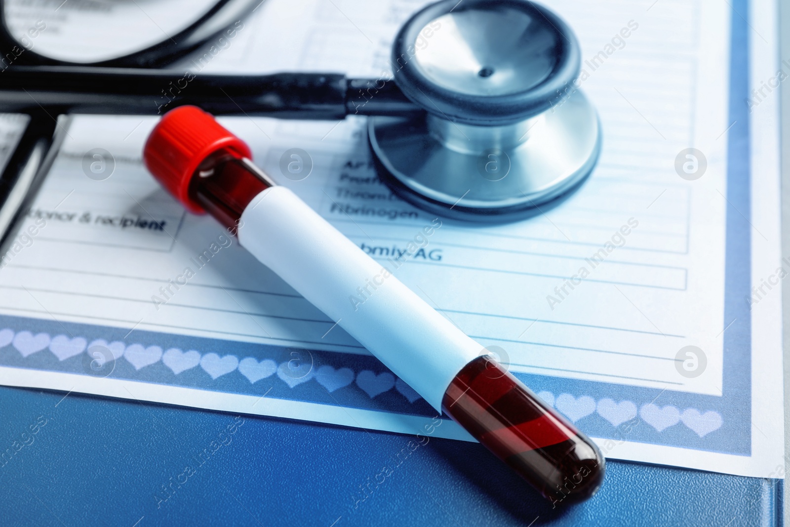 Image of Blood in sample tube with blank label on medical form. Laboratory analysis