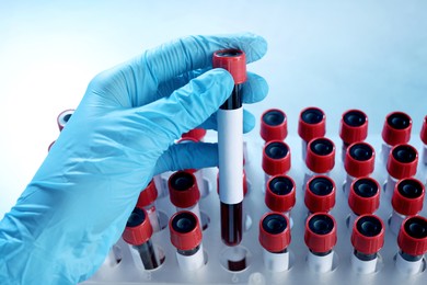 Laboratory worker putting sample tube with blood and blank label into rack, closeup. Medical analysis