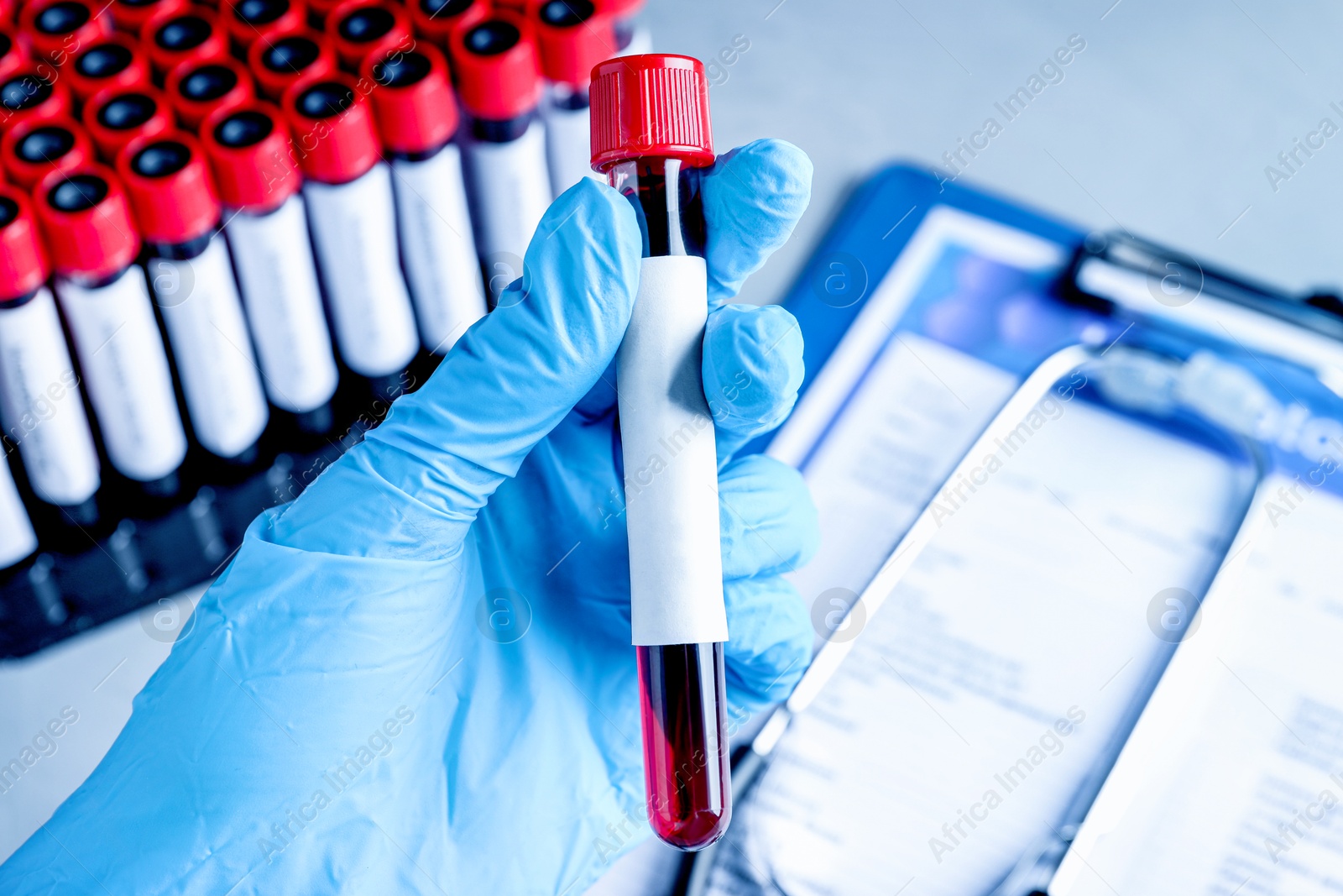 Image of Laboratory worker holding sample tube with blood and blank label over table, closeup. Medical analysis