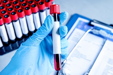 Image of Laboratory worker holding sample tube with blood and blank label over table, closeup. Medical analysis