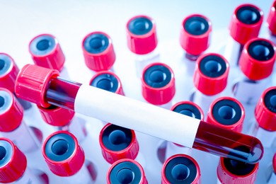 Image of One sample tube with blood and blank label on others, closeup. Laboratory analysis